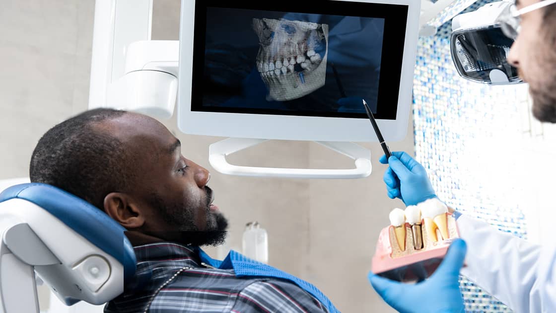 Dental Implants Photo